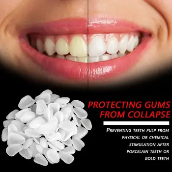 Зъбните Лепенки Фасети на зъбите Временна корона от смола За възстановяване на устната кухина Ултра Накладное Избелване на зъбите Тънък материал, за да се грижи за стоматолог T1Y2
